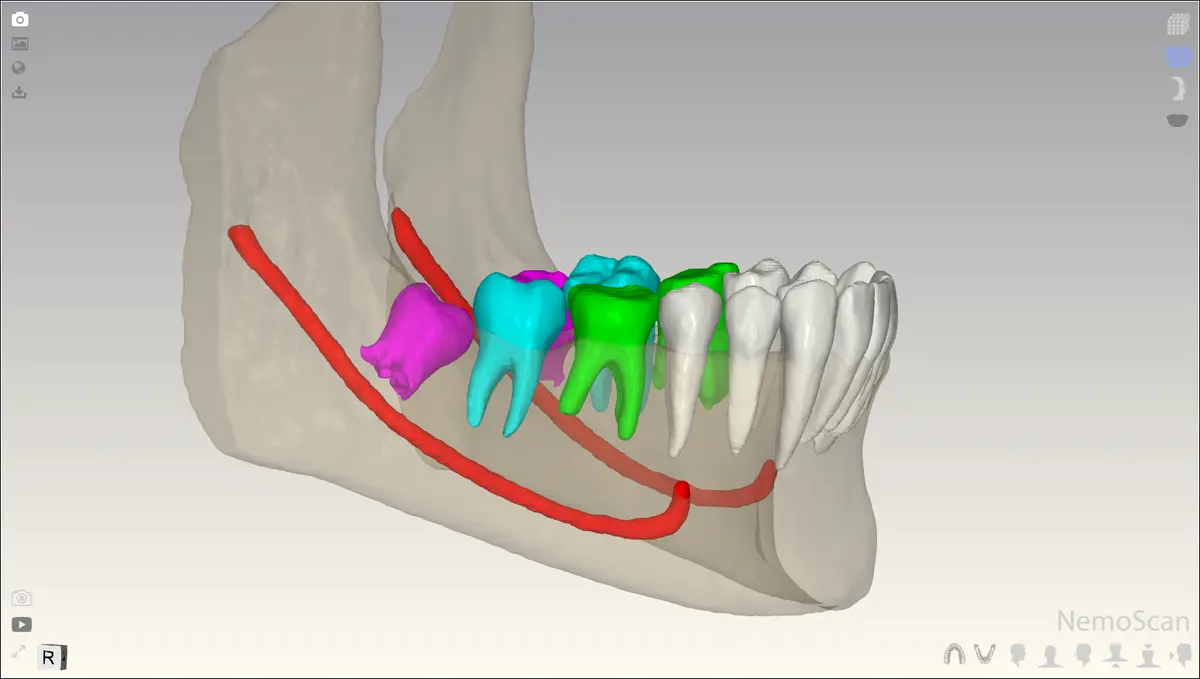 digital oral workflow