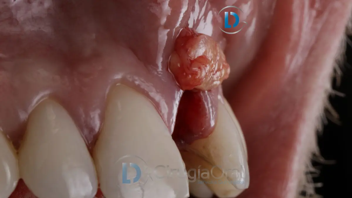 soft-tissue-management